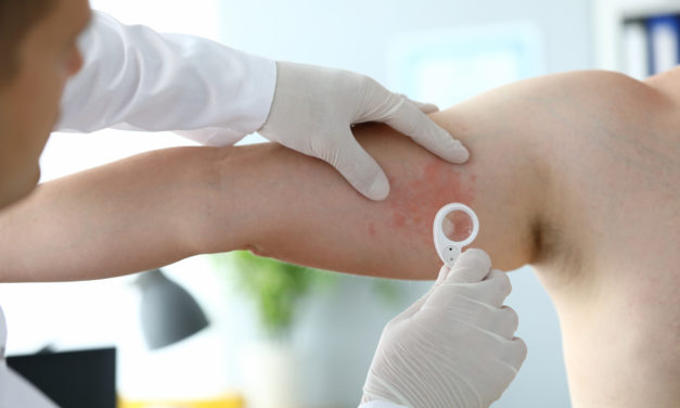 Nye symptomer på corona bekræftet!