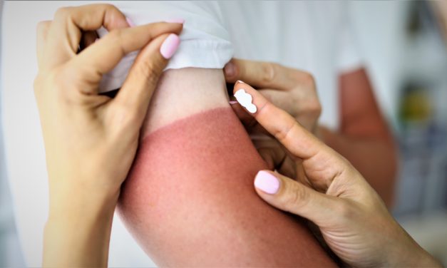 Har du styr på Uv-indekset? Sådan beskytter du dig i solen!